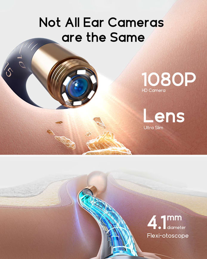 Original Bebird EarSight Plus I35R-R37R-D39R Compact All-in-1 Visual Ear Wax Remover Portable Ear Cleaner Oral Otoscope Camera