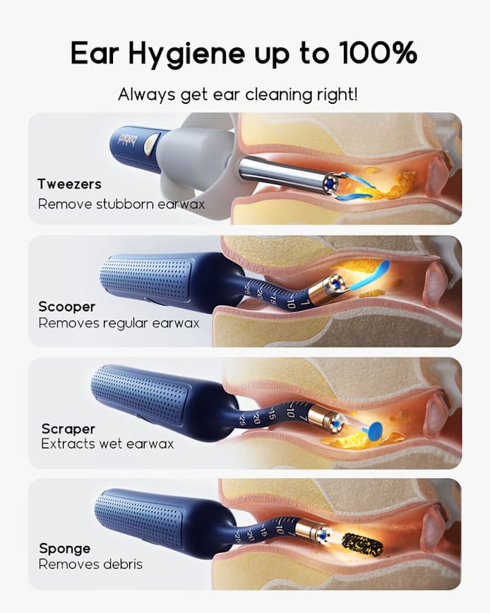 Original Bebird EarSight Plus I35R-R37R-D39R Compact All-in-1 Visual Ear Wax Remover Portable Ear Cleaner Oral Otoscope Camera