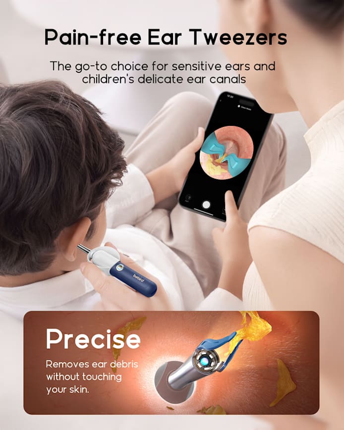 Original Bebird EarSight Plus I35R-R37R-D39R Compact All-in-1 Visual Ear Wax Remover Portable Ear Cleaner Oral Otoscope Camera